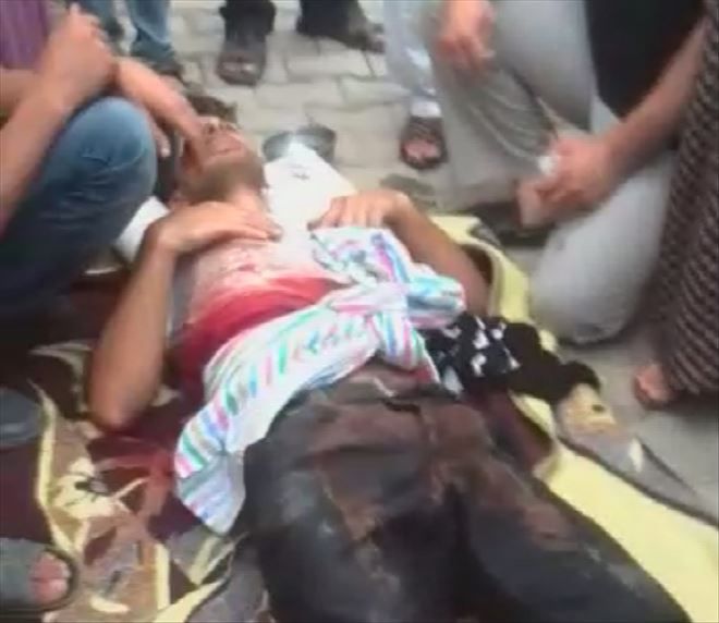 Nusaybin´de Suriye Uyruklu 1 Kişi Vurularak Yaralandı